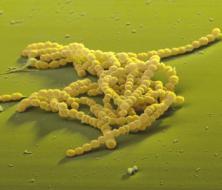 and Lactococcus Staphylococcus divides in random planes to generate irregular grapelike clumps S.