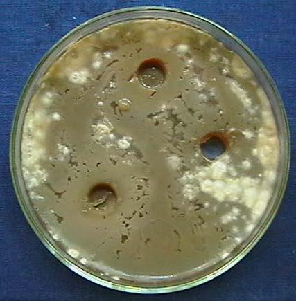Also shown that almost all the strains of bacteria inhibited the growth of pathogenic fungi F. solani M3 and F.