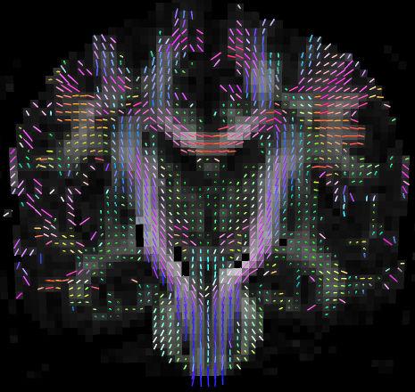 Signal models & tractography
