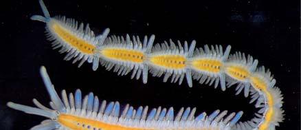 Polychaete nematode - Darkfield 2 Types