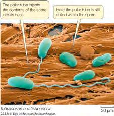 Microsporidia are highly reduced, parasitic fungi Obligate intracellular parasites