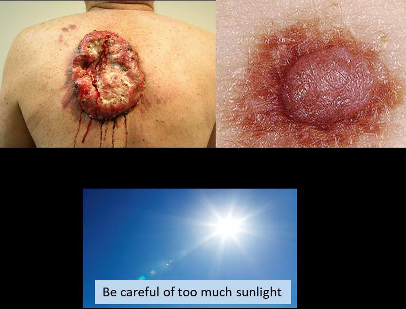 Ultraviolet (UV) light f 14 17 ~ 7.5 10 to 10 Hz 400 to 3 nm UV radiation can have harmful effects on the skin and long exposure can increase the risk of developing skin cancers.