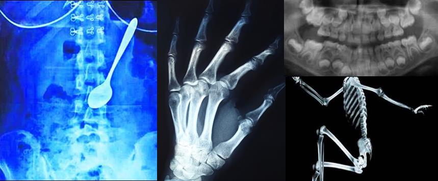 The use of X- ray images is a very important diagnostic tool used in medicine by doctors.