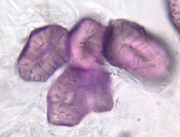 3. Osteosclereids bone-shaped sclereids (rod-like with swollen ends), subepidermal region of legume seeds. 4.