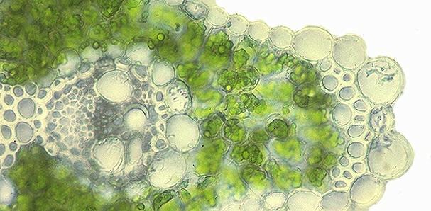 Simple Tissues : Parenchyma Some parenchyma cells have many chloroplasts and form the tissues found in leaves. This type of tissue is called chlorenchyma.