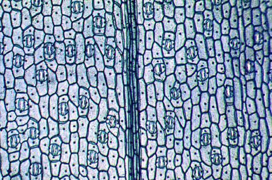 Complex Tissues : Epidermis The epidermis is also a complex plant tissue, and an interesting one at that.