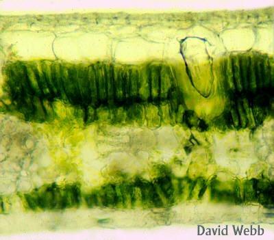 The outermost layer of the primary plant body is made up of the epidermis.