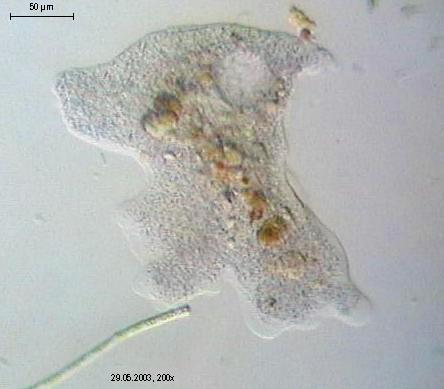 Diatoms amoeba