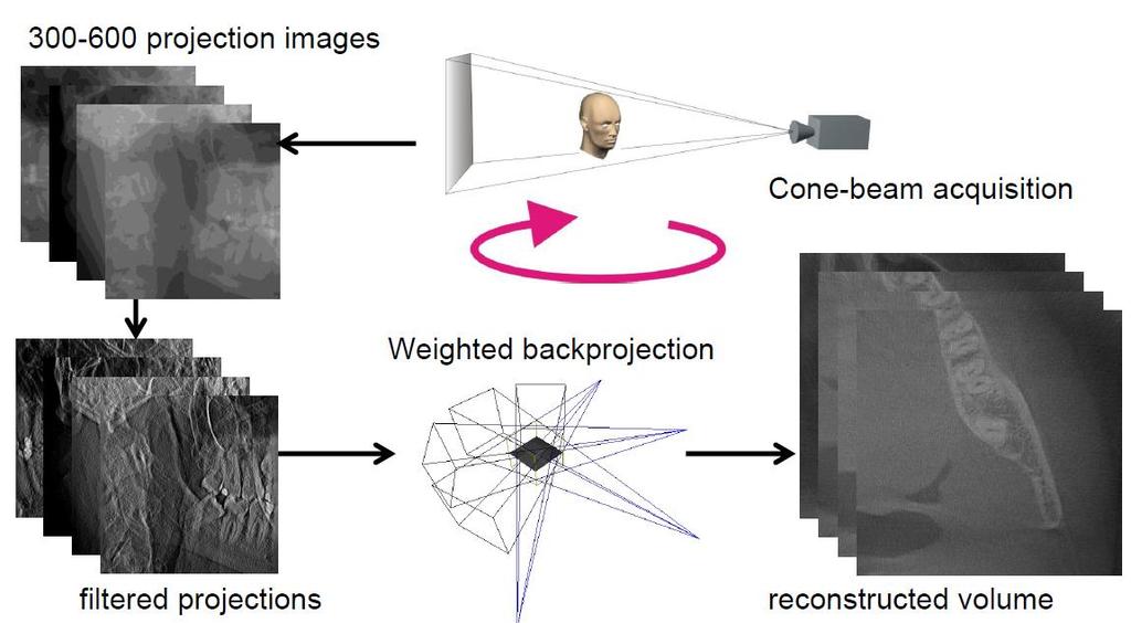 CT Principles 3D-Reconstruction Workflow