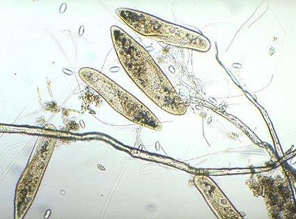 Was the first person to see bacteria Discovered that baker s yeast is a Single-celled organism.