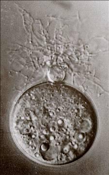 Fungal-like protists