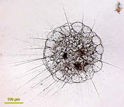 Clade: Stramenopiles Actinosphaerium heliozoan no test/shell hair-like