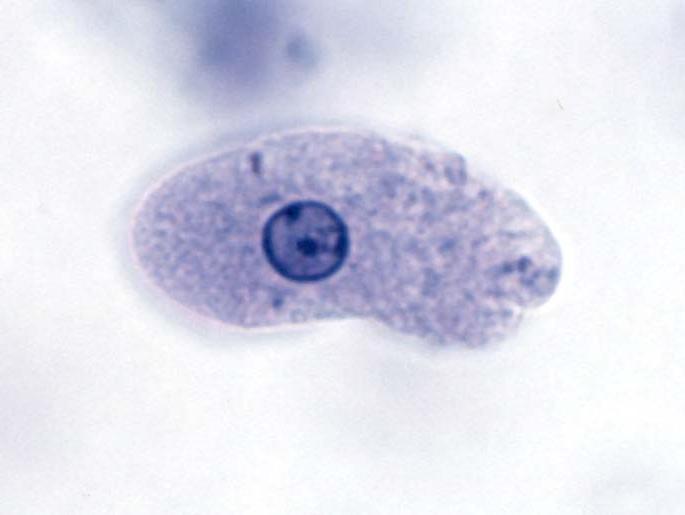 Amoebozoans Entamoeba histolytica anaerobic