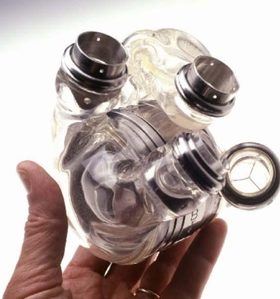 Artificial Heart Image: health.howstuffworks.