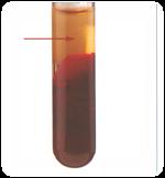 Sample Handling and Storage The following are guidelines for proper storage and handling of blood samples to assist in uniform quality samples: Collect 2-3 ml blood; this will yield 0.5-0.