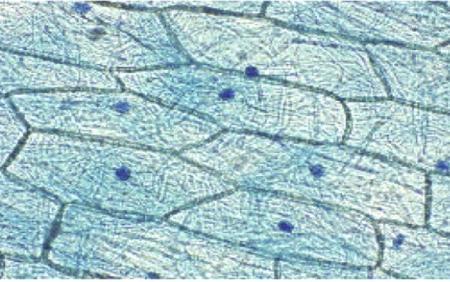 Dermal Tissue Epidermis is the outermost layer of the plant Protection from drying out and mechanical injury These cells are: square shaped (bricks) closely packed with no air