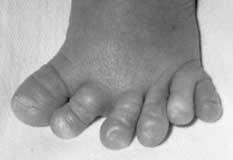18 Biology questions 7 Sometimes babies are born with extra fingers or toes as shown in the