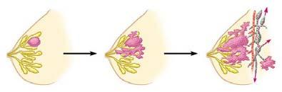 Cancer cells produce tumors Cancer cells escape controls on the cell cycle Cancer cells divide