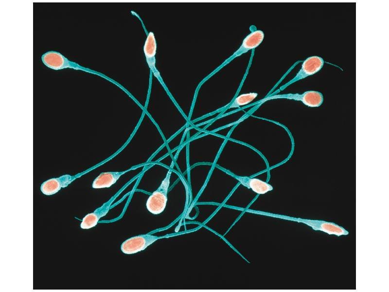 Spermatogenesis Occurs in the testes Two divisions produce 4 spermatids
