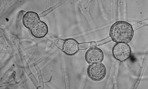 Asexual reproduction chlamydospores Chlamydospore: a chlamydospore is a