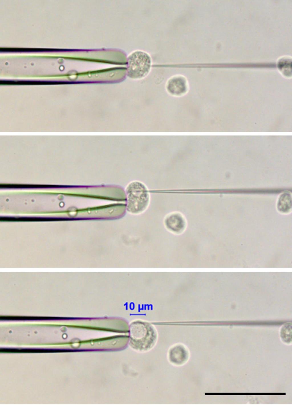 Fig. S Three continuous images during microinjection into trophozoites of Entamoeba invadens.