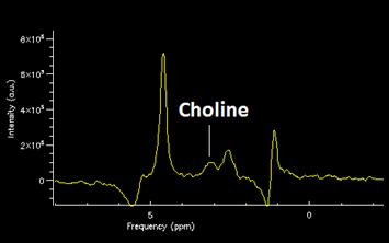 For example, examine the molecule, choline below.
