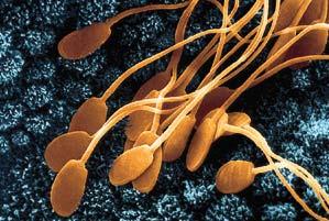 cells that have flagella have few (usually 1 or 2)