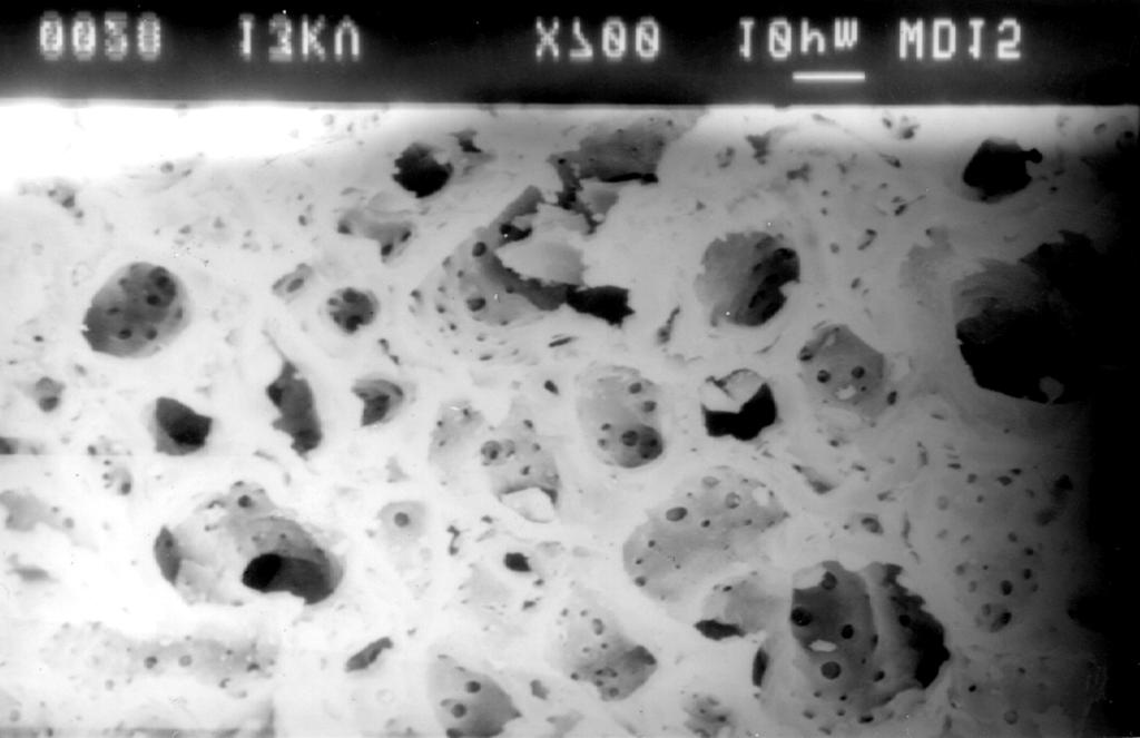 This fact can be quite clear from the SEM studies on chars and activated carbons of both samples. Plates 1 and 3 show SEM micrographs of Walnut shell and Groundnut shell based chars.