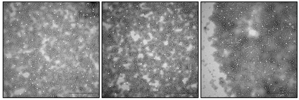 Analyzed TEM Images for Worm Lengths Measured worms are