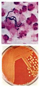 Domain: Bacteria Group: Gram-positive bacteria Streptococcus Coccus shape & gram