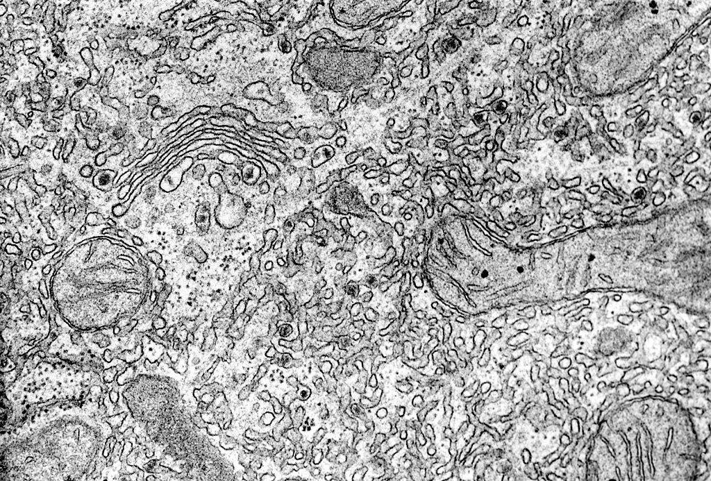 boundaries Goldgi apparatus (dictyosomes) 2 Golgi complex and smooth endoplasmic reticulum in