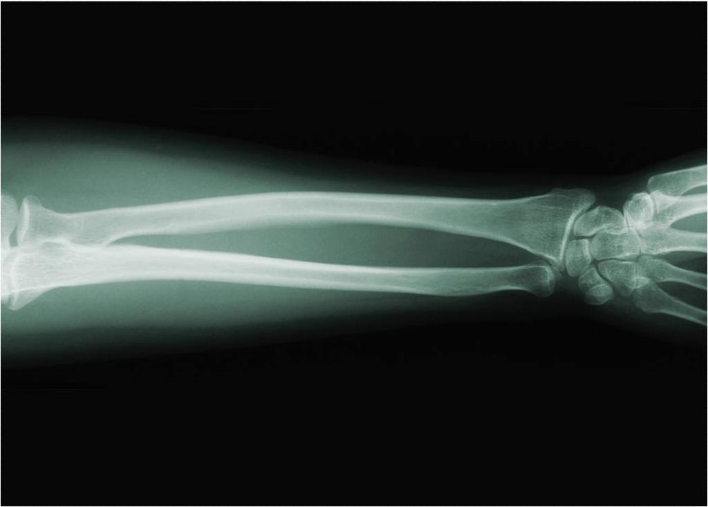 X Rays X rays have a shorter wavelength and a higher frequency than ultraviolet radiation.