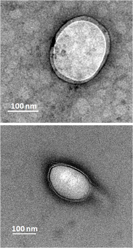 Figure SF 8b: Transmission Electron Microscopic images of DEX-PDP-7 vesicles negatively stained using 0.2 % uranyl acetate.