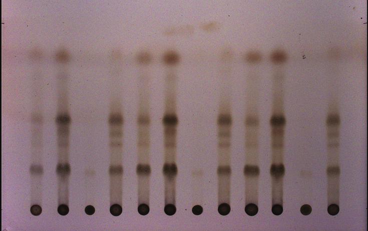 5 Desmethoxycurcumin.9 2.6 Bisdesmethoxycurcumin.5 1.5 Figure 8: Standard conditions and chromatogram for identification of ginger extract using TLC.