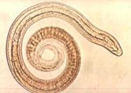 Tapeworms