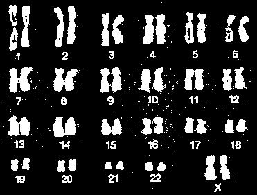 Page #3 Karyotype Karyotype = a photo of the chromosomes in