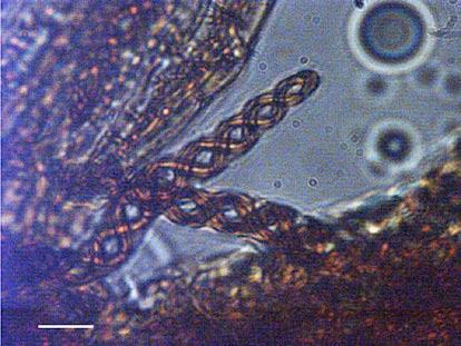 S. Laaka-Lindberg & K. Syrjänen: Sporophytes of Cephalozia macounii 493 hazards in the germination phase, which reduces the reproductive benefit of easily dispersed spores.