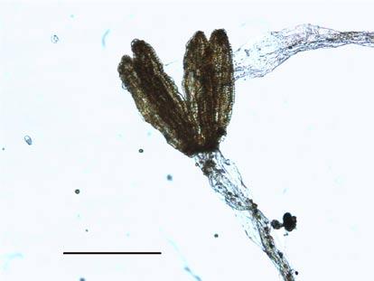 Photograph of opened sporophyte of Cephalozia macounii (Aust.) Aust. Scale bar = 1 mm. (e.g., Schuster 1974).