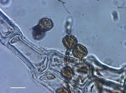 The overall sporophyte characteristics are similar to those in its close relative C. leucantha Spruce (e.g., Damsholt 2002), including the shape and size of the spores. The spores of C.