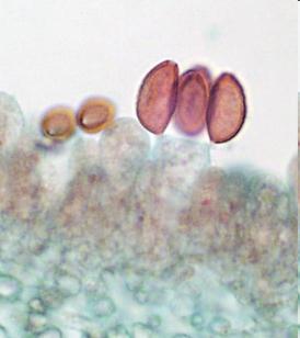Basidiomycota Cells: Septate