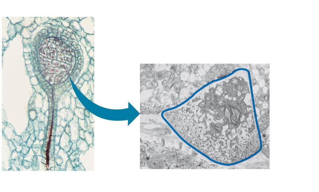 Multicellular, Dependent Embryos Embryo (LM) and placental transfer cell (TEM) of Marchantia (a liverwort) Embryo Maternal tissue Zygotes develop