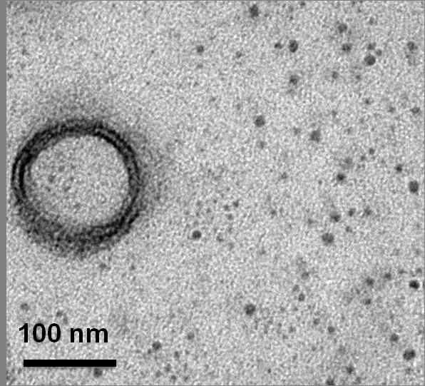 Fig. S15 TEM image of the intermediate state from micelles formed by G2 to vesicles formed by WILP6 G2 (scale