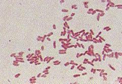 cholerae and Bordetella pertussis Staphylococcus