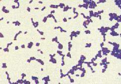 Not all bacteria can be stained by Gram's method, the