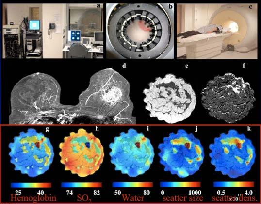 Optical tomography of tissue chromophores 25 40 74 82 50 80 0