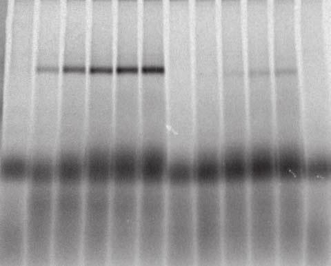 After solubilization in digitonin buffer, samples were subjected to blue native electrophoresis and analyzed by digital autoradiography.