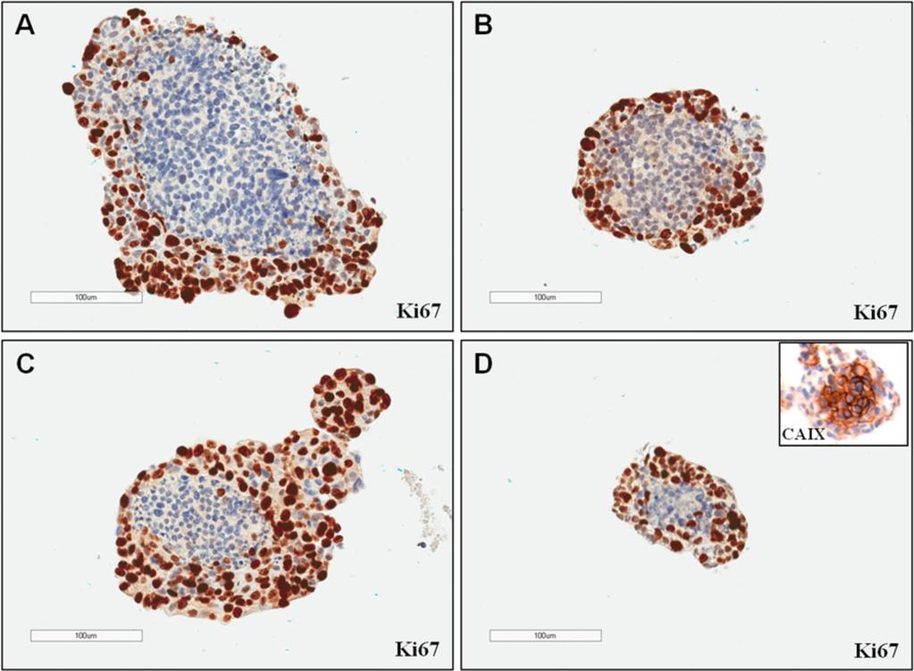 Supplementary Figure S2: Proliferative outer spheroids MARY-X cellular region and dormant tumor cell core.