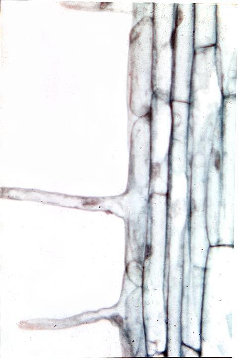 ROOT HAIRS: tubular extensions of epidermal cells.