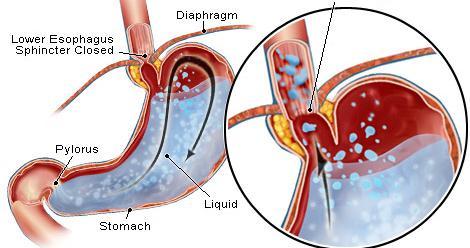 Applications Certain body fluids are acidic: Stomach acid and