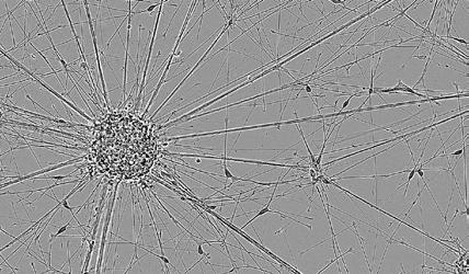 Here we tested three commonly used culture substrates +/- secondary laminin or Matrigel coating to determine optimal conditions for in vitro cellular morphology and neurite